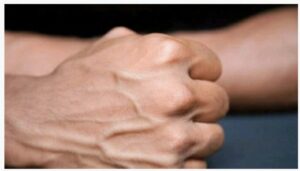 If You Notice His Veins Are Like This, See What It Means